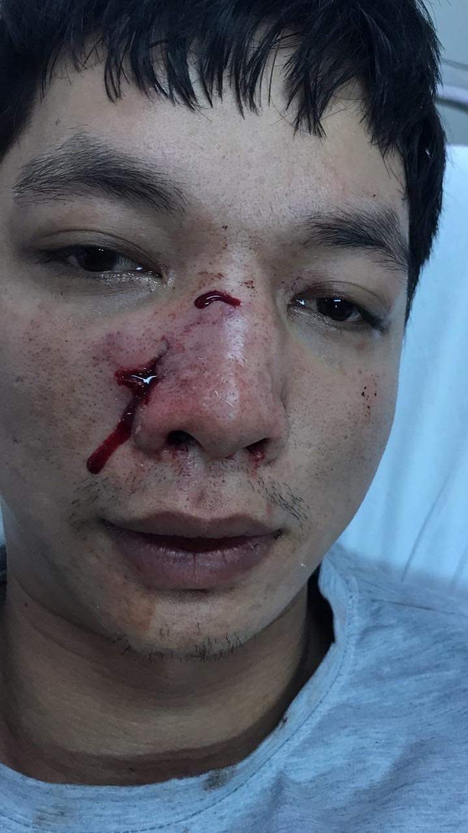 Cả gia đình đi bẫy thú rừng xông vào trạm bảo vệ rừng tấn công cán bộ - 2 Cả gia đình đi bẫy thú rừng xông vào trạm bảo vệ rừng tấn công cán bộ - 2