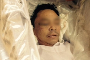 Vụ bệnh nhân tâm thần bị đánh chết: Bệnh viện thách gia đình khởi kiện?