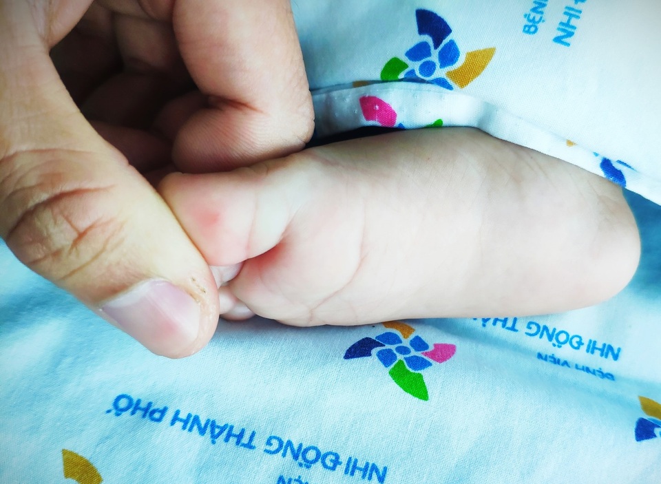 Nốt hồng ban nhỏ trên chân khiến bé gái nguy kịch - 2 Nốt hồng ban nhỏ trên chân khiến bé gái nguy kịch - 2