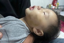 Xác minh thông tin bé gái 9 tháng tuổi nghi bị đánh bầm má tại điểm giữ trẻ