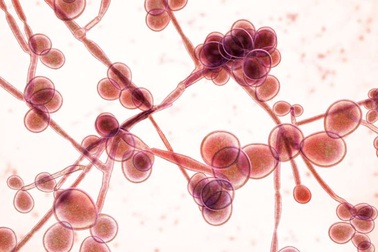 Siêu nấm kháng thuốc chết người đang lan rộng khắp nước Mỹ