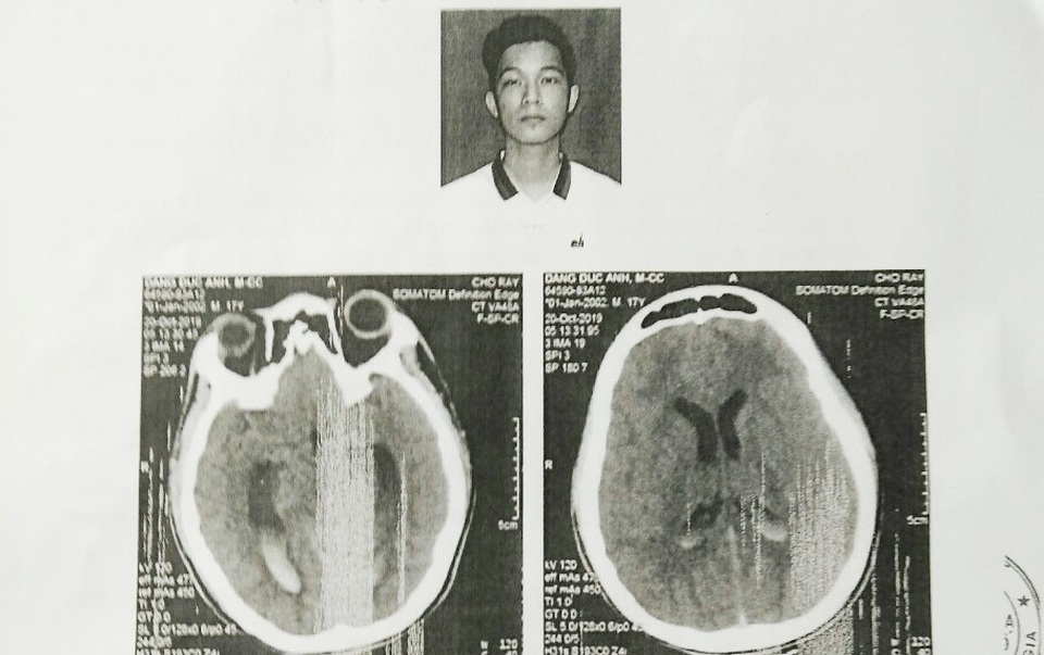 Phục hồi điều tra vụ nam sinh bị đánh chấn thương não ở Bạc Liêu - 2 Phục hồi điều tra vụ nam sinh bị đánh chấn thương não ở Bạc Liêu - 2