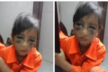 Tát bầm mặt, đánh thâm mông chưa bao giờ là một phương pháp giáo dục!