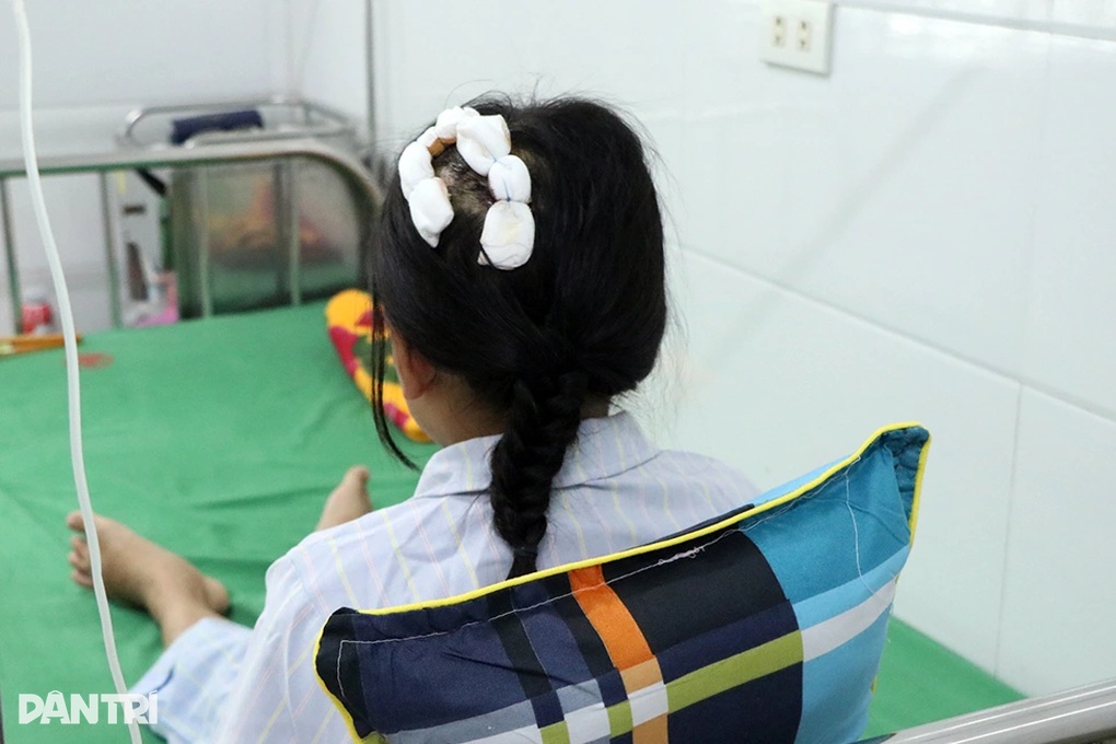 ¿Cómo está la salud del niño que fue golpeado en la cabeza con un martillo por su padrastro? - 3 Sức khỏe của bé bị cha dượng dùng búa đánh vào đầu hiện ra sao? - 3