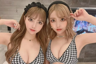 Cặp sinh đôi Nhật Bản "gây sốt" vì dao kéo toàn bộ gương mặt giờ ra sao?