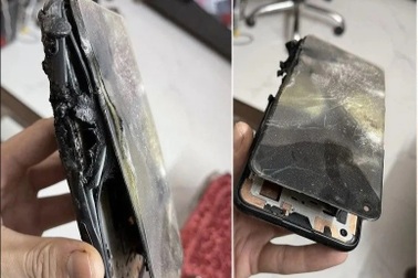 Smartphone bất ngờ phát nổ khi người dùng đang gọi điện