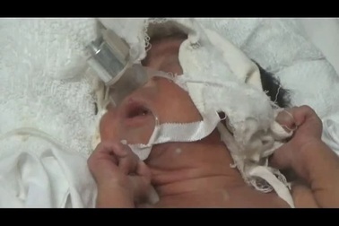 Tiếng khóc khát sống của cậu bé sinh non từ người mẹ bị phát bệnh dại