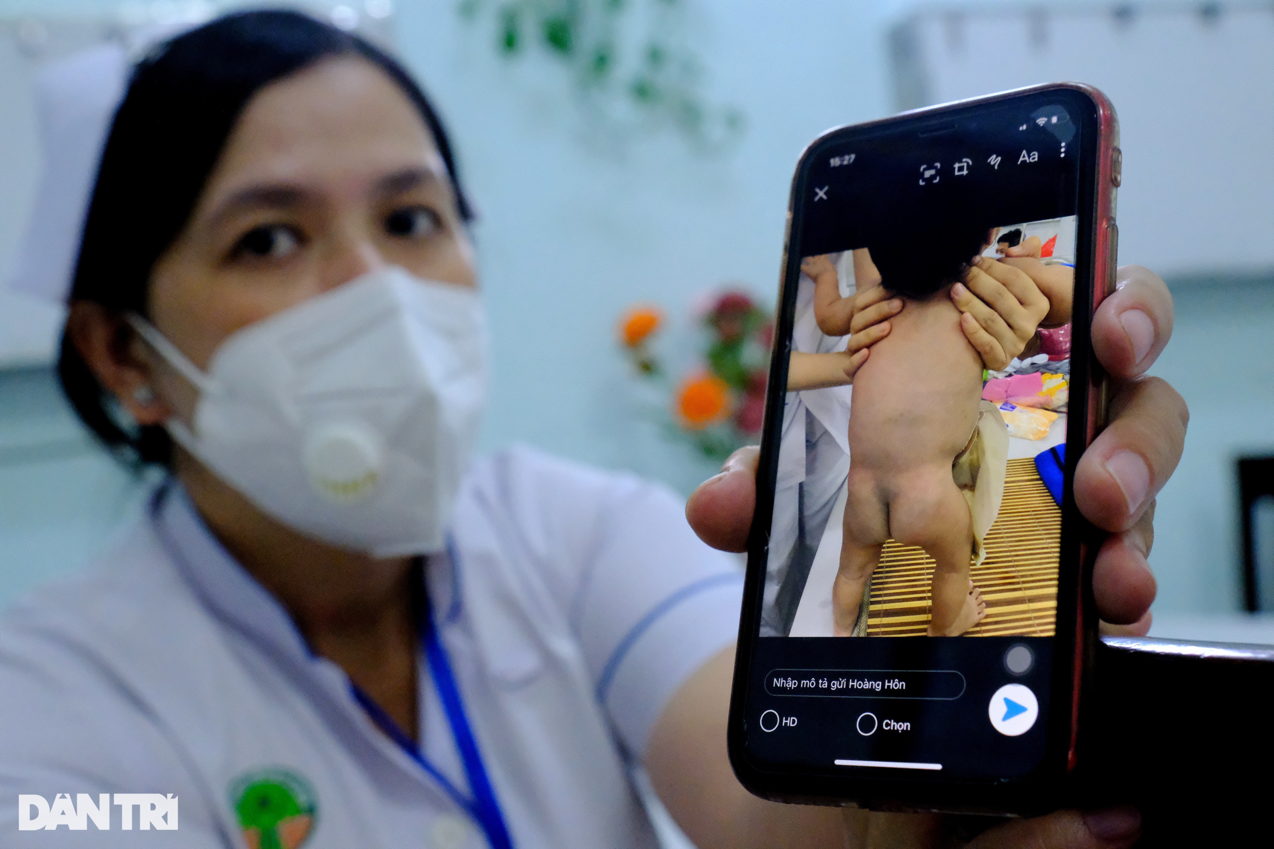 Cha ruột quyết bỏ rơi, bé Mén thành con gái của 52 y bác sĩ BV Nhi Đồng 2 - 5 Cha ruột quyết bỏ rơi, bé Mén thành con gái của 52 y bác sĩ BV Nhi Đồng 2 - 5