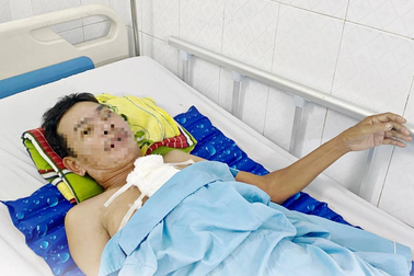 Người đàn ông 63 tuổi bị trâu húc vỡ tim, gãy nát xương ức