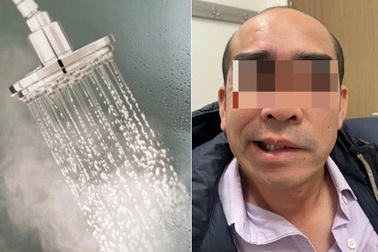 Cách tắm khiến người đàn ông Hà Nội liệt mặt, méo miệng