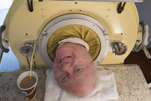 Người đàn ông hơn 70 năm sống nhờ "lá phổi sắt" qua đời