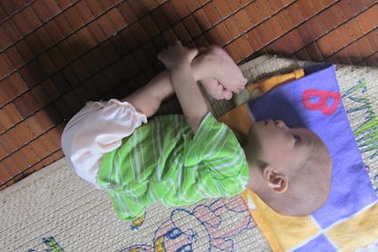 Bé gái 11 tháng tuổi chỉ nặng 4kg vì mắc bệnh tim bẩm sinh phức tạp