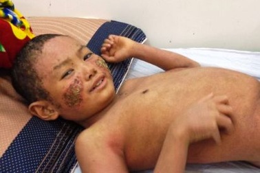 Cháu Kỳ “vảy nến” đón Tết trong hình hài mới