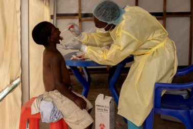 WHO ban bố tình trạng khẩn cấp y tế toàn cầu vì đậu mùa khỉ