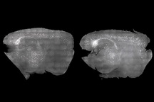 Phương pháp mới giúp “dọn sạch” mảng bám Alzheimer từ chuột chỉ bằng ánh sáng và âm thanh