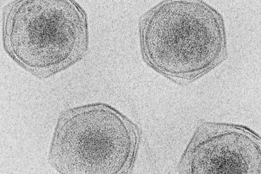 Mehr als 230 Riesenviren entdeckt, deren Größe weit über dem Normalen liegt - 1 Phát hiện hơn 230 virus khổng lồ, kích thước vượt xa thông thường - 1