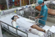 Thương tâm cháu bé bị mẹ tưới xăng đốt vì không bán hết vé số