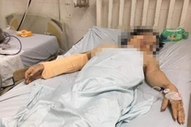 Nghi án chồng dùng gậy dài 1m đánh vợ cũ dã man