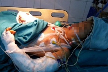 Cháu Bích sẽ được điều trị tâm lý