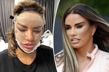 Người mẫu tự tin khoe sắc sau loạt ảnh gây sốc từ phòng hậu phẫu