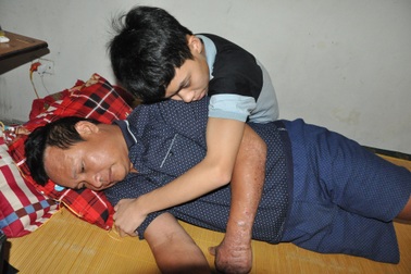 Cậu bé học sinh giỏi quốc gia cầu mong có 30 triệu lắp chân giả cho bố