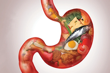 90% bệnh nhân ung thư đường ruột có những dấu hiệu này: Đừng bỏ qua!