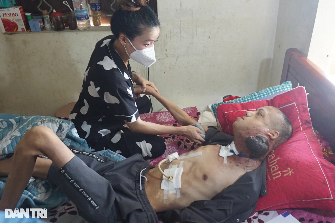 Bi kịch ập đến sau đám cưới, chiến sĩ công an đếm sự sống từng ngày - 6 Bi kịch ập đến sau đám cưới, chiến sĩ công an đếm sự sống từng ngày - 6
