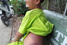 Long An: Đình chỉ công tác 15 ngày với cô giáo đánh học sinh khuyết tật bầm người