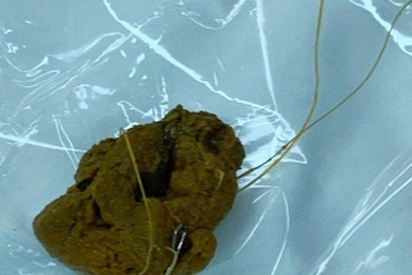 Ăn cá, nuốt luôn cả lưỡi câu và dây câu vào bụng