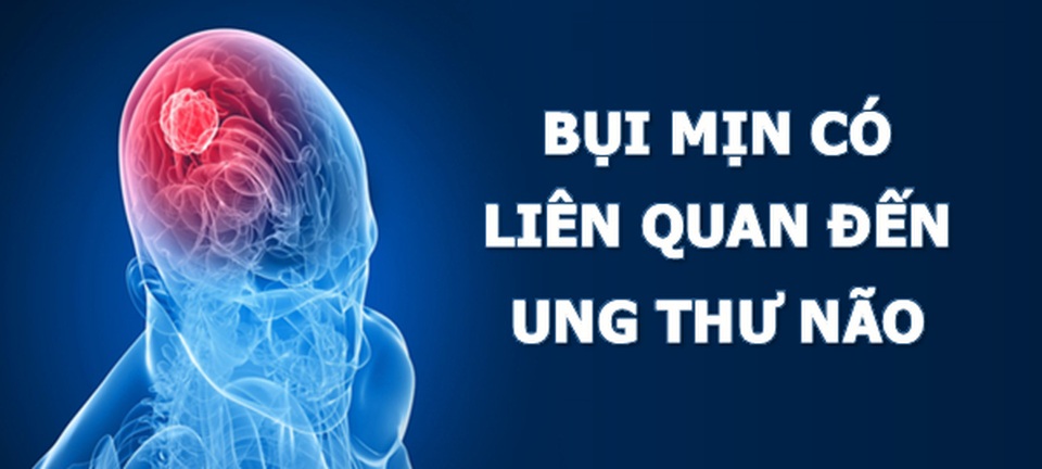 Phát hiện mới: Bụi mịn có mối liên quan tới nguy cơ mắc ung thư não - 2 Phát hiện mới: Bụi mịn có mối liên quan tới nguy cơ mắc ung thư não - 2