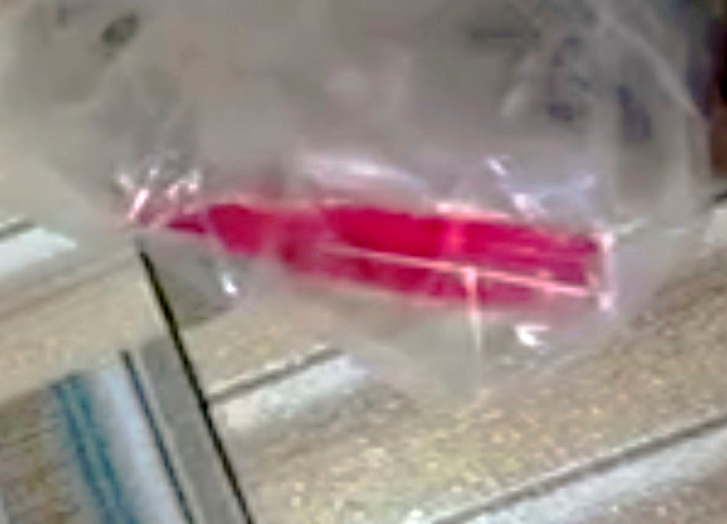 Cô gái tổn thương tim, não nặng sau uống ống thuốc màu đỏ - 1