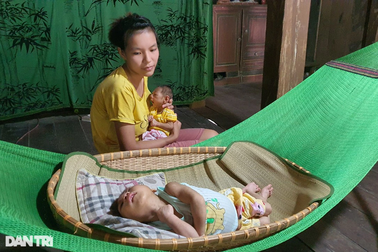 Nỗi đau người mẹ sống như đã chết khi có 2 con mắc bệnh teo não bẩm sinh