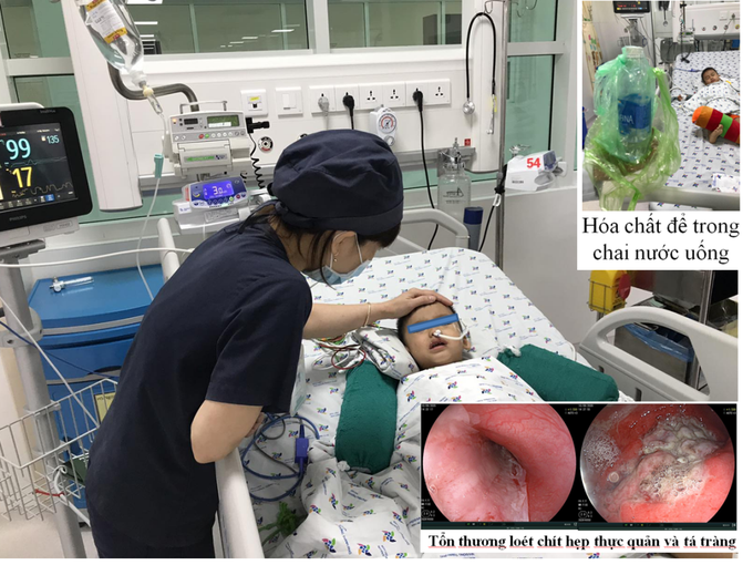 Bé 3 tuổi nguy kịch sau khi uống nhầm chai nước chống thấm nghe - Ảnh 1. Bé 3 tuổi nguy kịch sau khi uống nhầm chai nước chống thấm nghe - Ảnh 1.