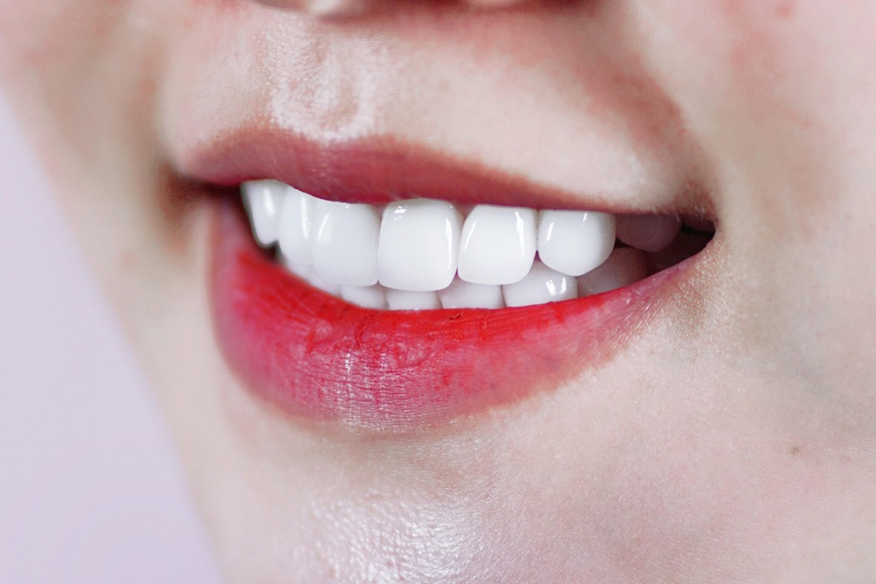 Khám phá ngay răng sứ Nano Shining tại Nha khoa Kami - 2