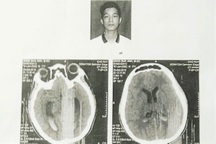 Khởi tố thêm 2 bị can vụ nam sinh bị đánh chấn thương não