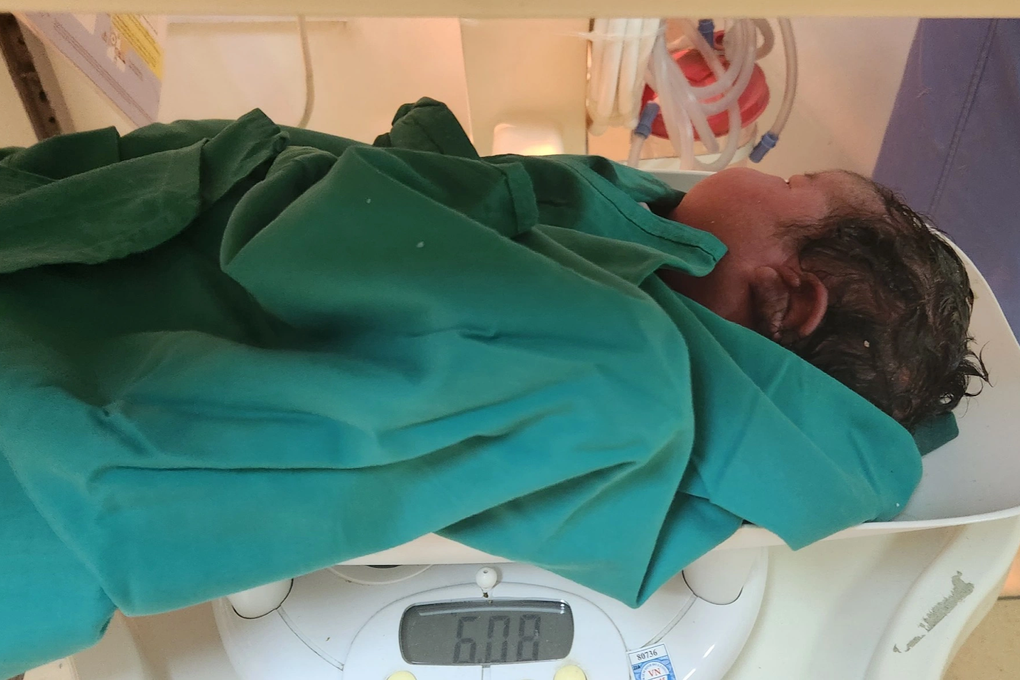 Các bác sĩ bất ngờ với bé trai chào đời nặng 6kg - 1 Các bác sĩ bất ngờ với bé trai chào đời nặng 6kg - 1