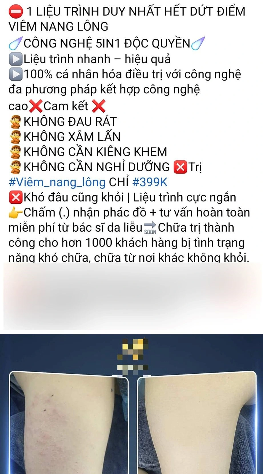 Những con mồi sập bẫy spa ngon, bổ, rẻ - 4 Những con mồi sập bẫy spa ngon, bổ, rẻ - 4