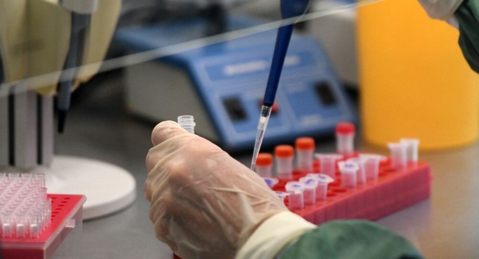 Nga nghiên cứu sử dụng Plasma lạnh chống lại sự lây lan Covid-19 - 1