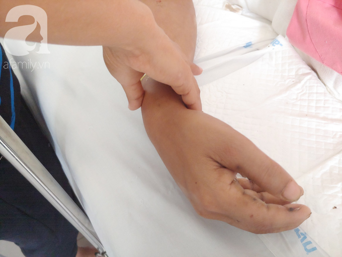 Chồng làm thợ hồ bị điện giật cháy khắp người, khóc nức nở vì làm khổ vợ và hai con thơ dại - Ảnh 13. Chồng làm thợ hồ bị điện giật cháy khắp người, khóc nức nở vì làm khổ vợ và hai con thơ dại - Ảnh 13.