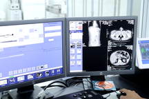 Quy trình khám tầm soát ung thư dạ dày tại Bệnh viện K