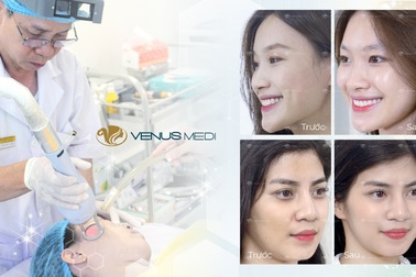 Trẻ hóa da đa tầng Multi Layer, bước tiến mới của công nghệ làm đẹp