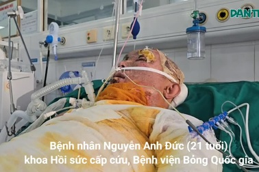 Chàng trai 21 tuổi bị bỏng điện cao thế, nằm mê man giành giật sự sống