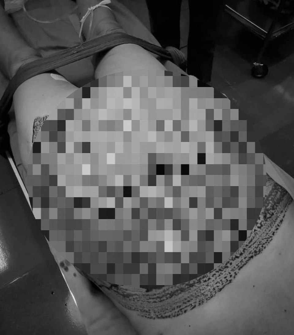 Ngăn bò chọi nhau, gia chủ bị bò nhà húc thủng bụng - 1 Ngăn bò chọi nhau, gia chủ bị bò nhà húc thủng bụng - 1