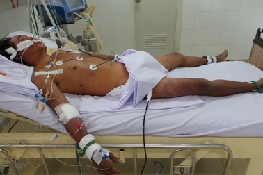 Hết vắc xin ngừa dại, người bị chó mèo cắn phải làm gì?