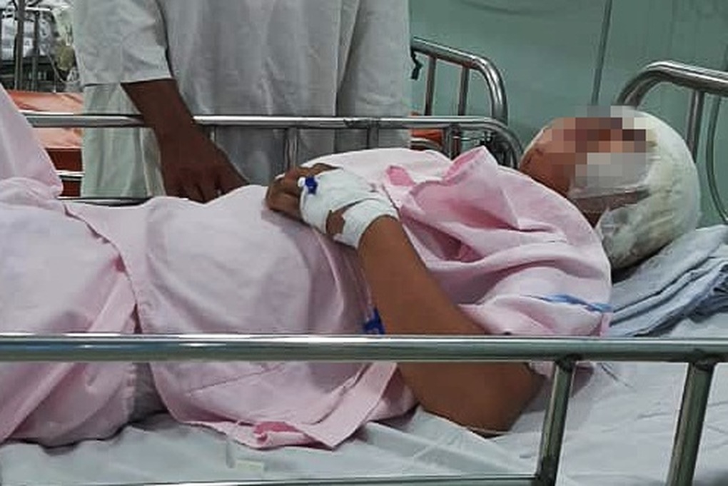 Bẫy chuột kiếm tiền phụ cha, bé gái 13 tuổi bị máy tuốt lúa lóc sạch da đầu - 2 Bẫy chuột kiếm tiền phụ cha, bé gái 13 tuổi bị máy tuốt lúa lóc sạch da đầu - 2