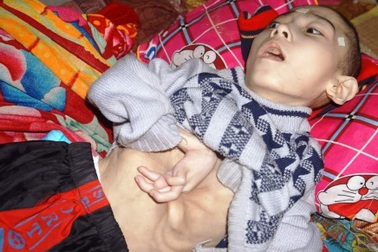 Xúc động tấm lòng bạn đọc giúp đỡ cậu bé nằm liệt 15 năm hơn 130 triệu đồng