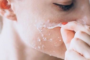 Đã có giải pháp sạch mụn, căng bóng đến từ Hoa Kỳ