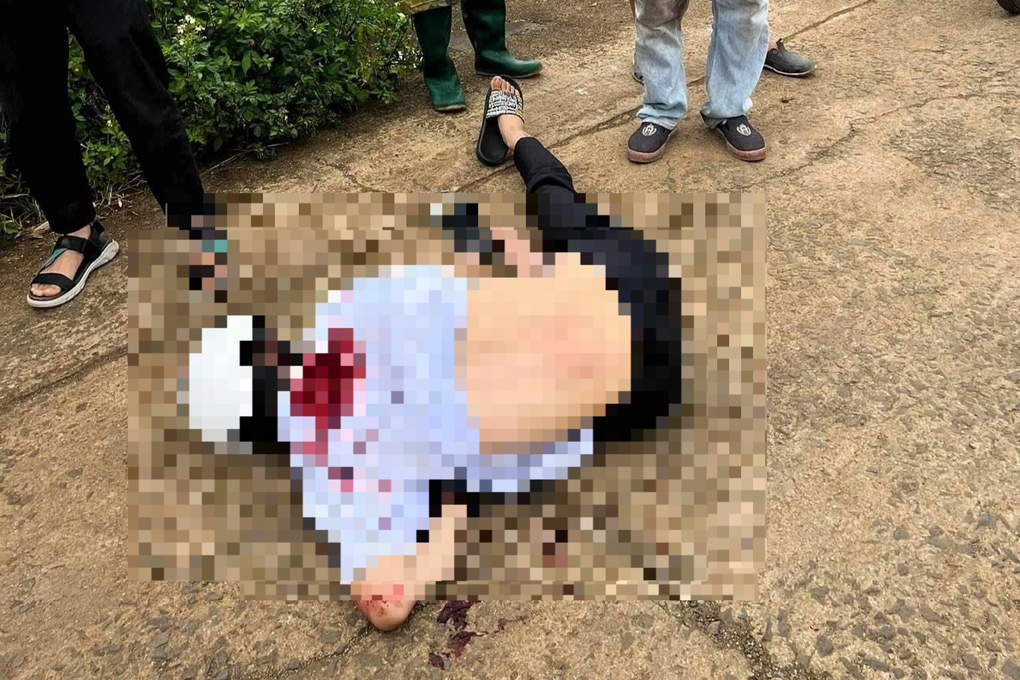 Công an truy tìm đối tượng chém nam sinh lớp 10 trọng thương - 1 Công an truy tìm đối tượng chém nam sinh lớp 10 trọng thương - 1