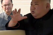 "Vết đỏ bí ẩn" trên cổ tay ông Kim Jong-un