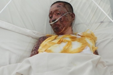 Nổ khí gas, chồng tử vong, vợ con bỏng nặng 